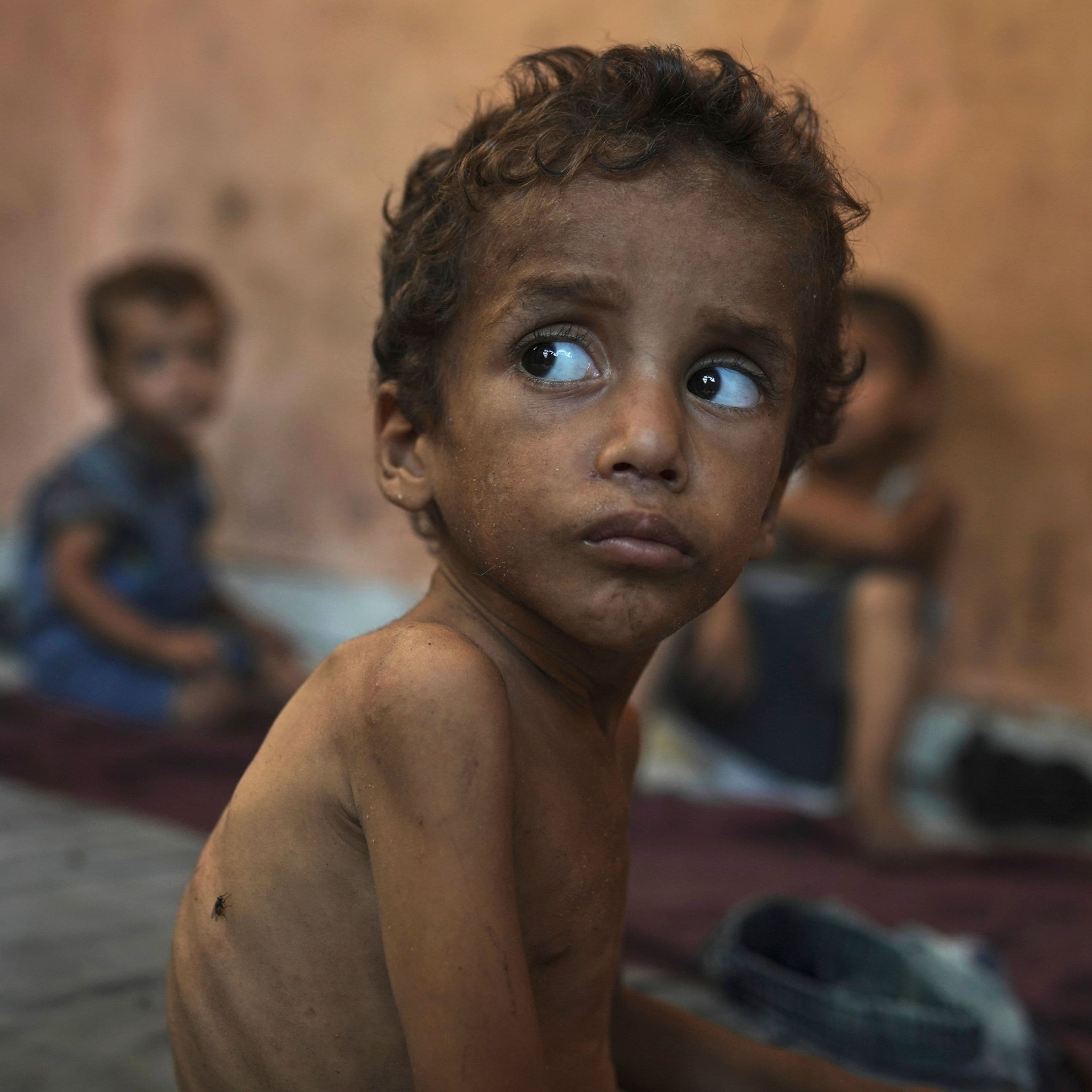 Gaza malnutrition 'catastrophic', warns Health Ministry