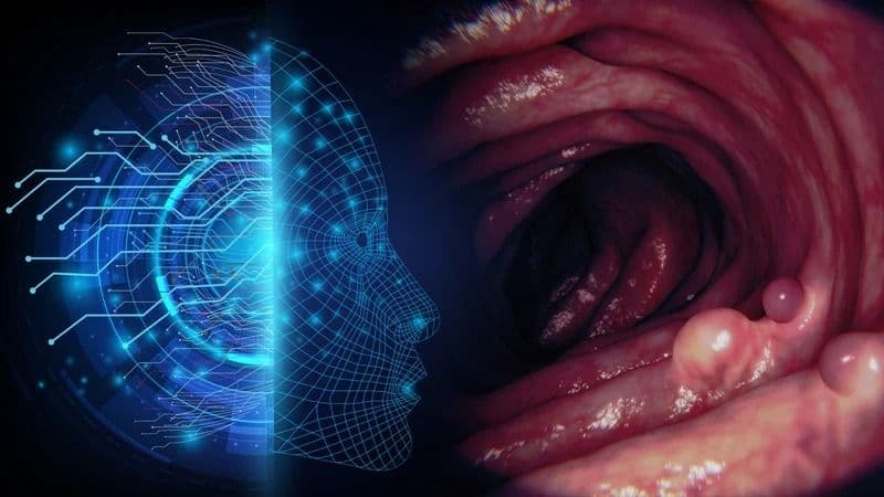 AI Gastrointestinal Cancer Detection: Fujifilm India Backs AIIMS Study